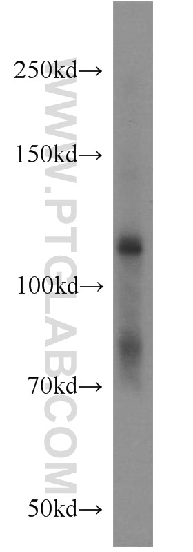 Western Blot (WB) analysis of PC-3 cells using EPHB4 Polyclonal antibody (20883-1-AP)