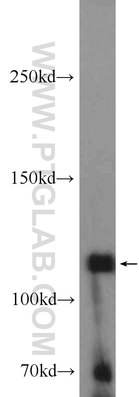 Western Blot (WB) analysis of DU 145 cells using EPHB4 Polyclonal antibody (20883-1-AP)