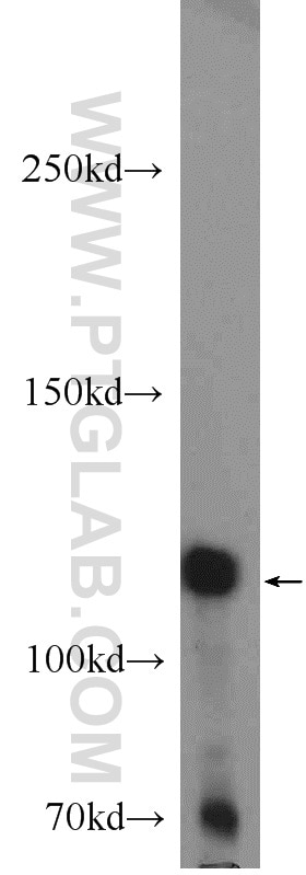 Western Blot (WB) analysis of DU 145 cells using EPHB4 Polyclonal antibody (20883-1-AP)