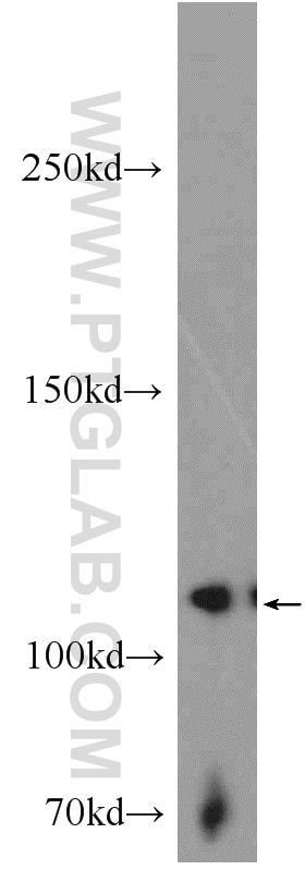 Western Blot (WB) analysis of PC-3 cells using EPHB4 Polyclonal antibody (20883-1-AP)