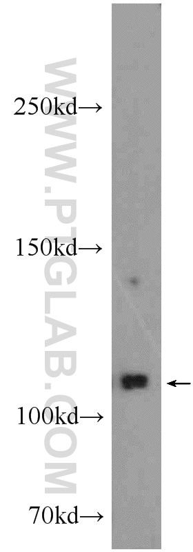 Western Blot (WB) analysis of PC-3 cells using EPHB4 Polyclonal antibody (20883-1-AP)