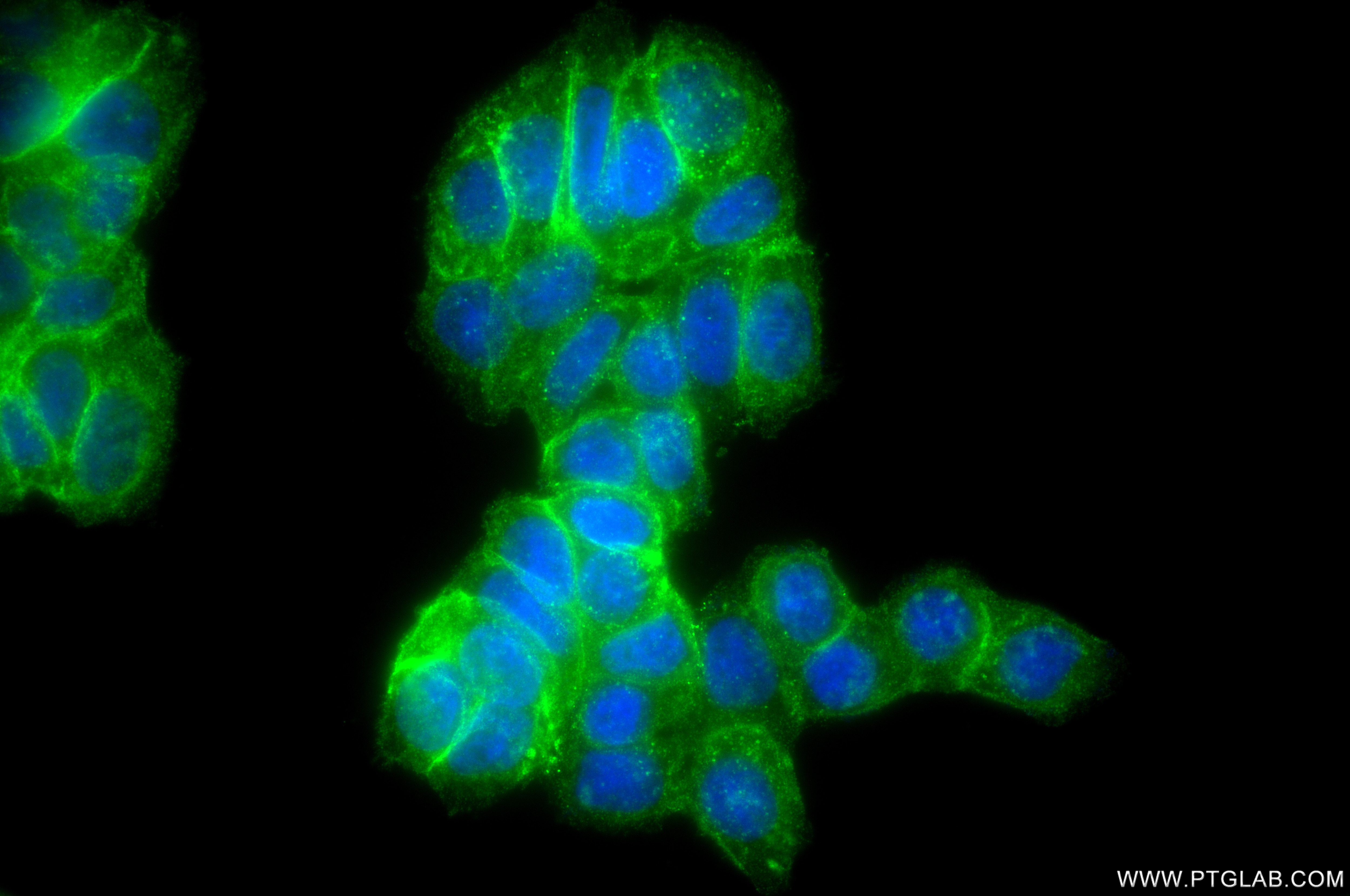 Immunofluorescence (IF) / fluorescent staining of HT-29 cells using EPHB4 Recombinant monoclonal antibody (85139-9-RR)