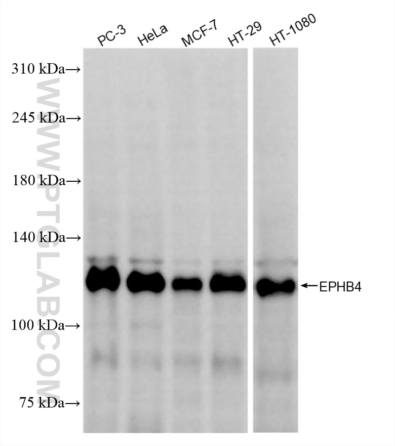 Western Blot (WB) analysis of various lysates using EPHB4 Recombinant monoclonal antibody (85139-9-RR)
