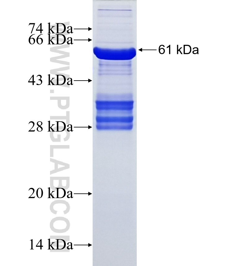 EPHB6 fusion protein Ag15992 SDS-PAGE