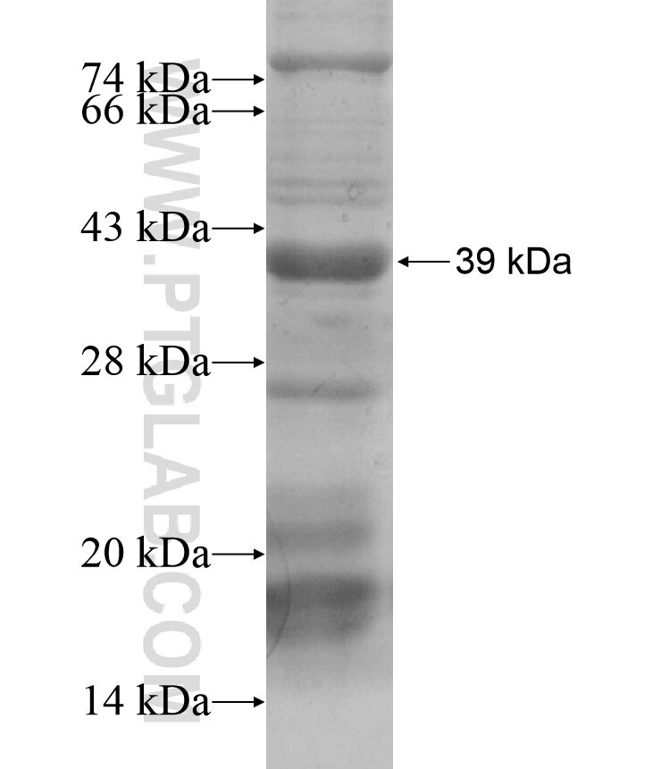 EPHB6 fusion protein Ag17487 SDS-PAGE