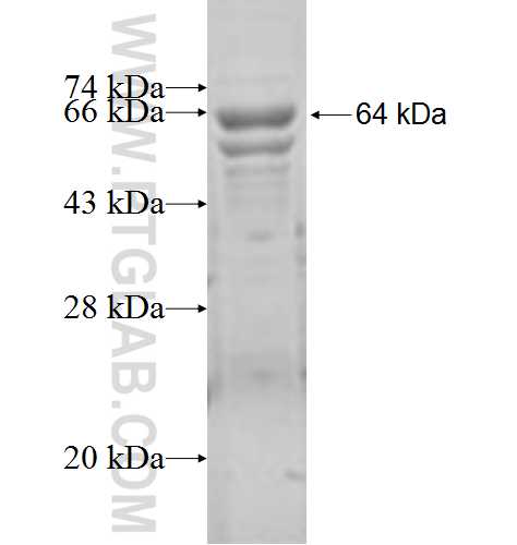 EPHX1 fusion protein Ag7443 SDS-PAGE