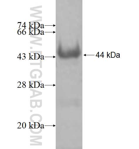 EPHX1 fusion protein Ag7465 SDS-PAGE