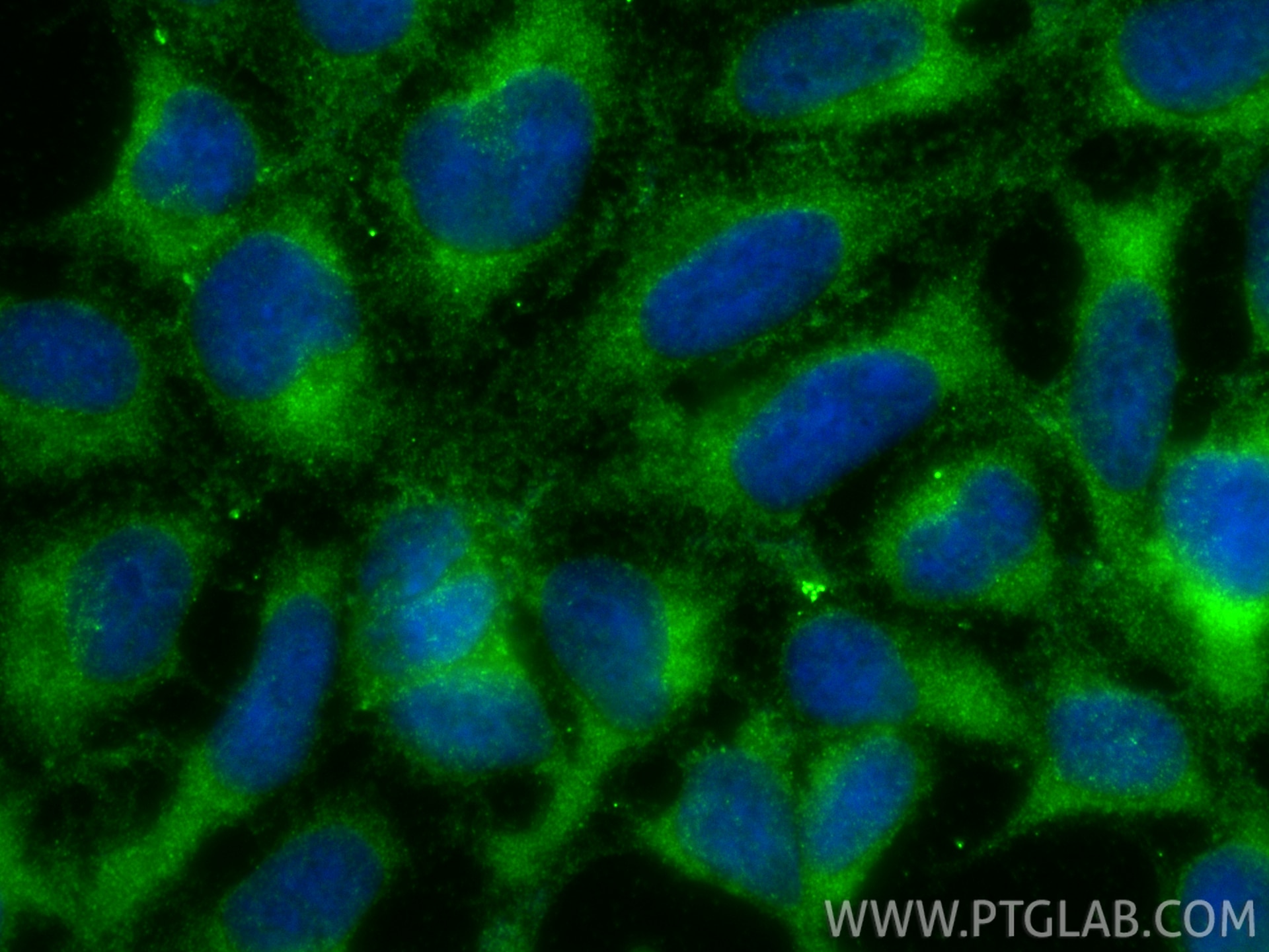 Immunofluorescence (IF) / fluorescent staining of HEK-293 cells using EPHX2 Polyclonal antibody (10833-1-AP)
