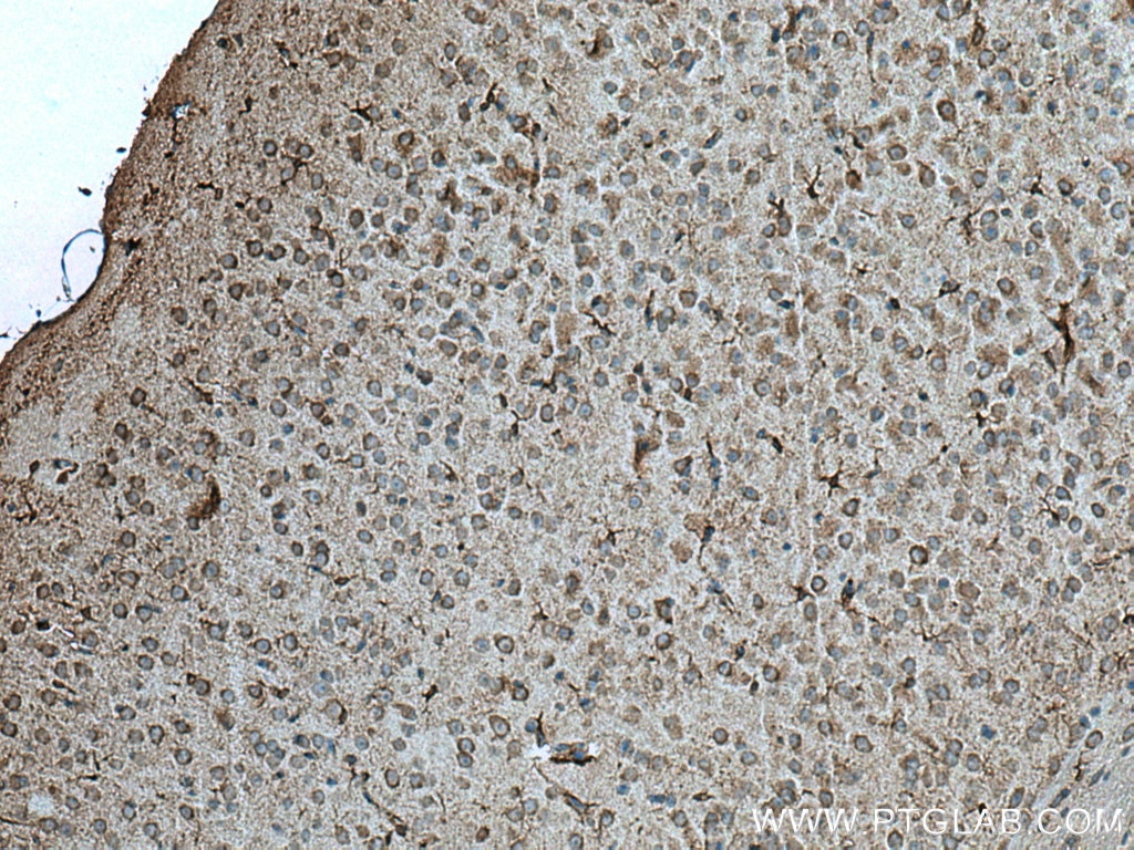 Immunohistochemistry (IHC) staining of mouse brain tissue using EPHX2 Polyclonal antibody (10833-1-AP)