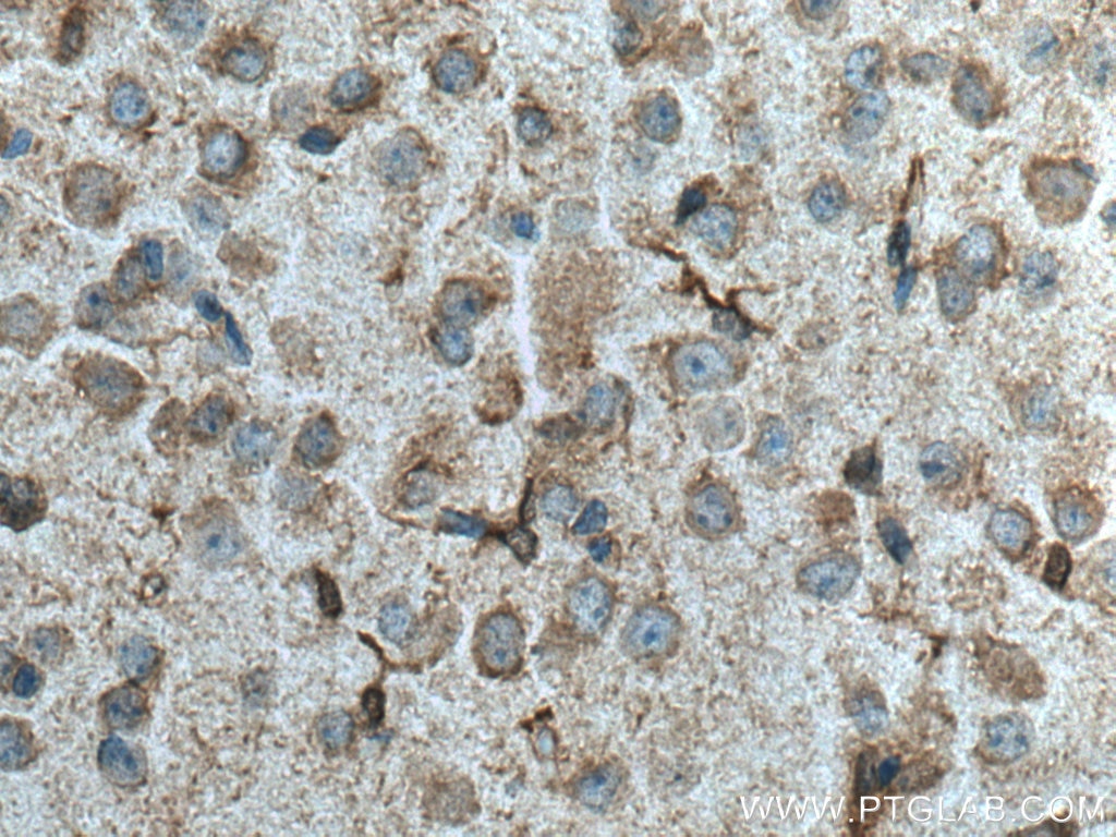 Immunohistochemistry (IHC) staining of mouse brain tissue using EPHX2 Polyclonal antibody (10833-1-AP)