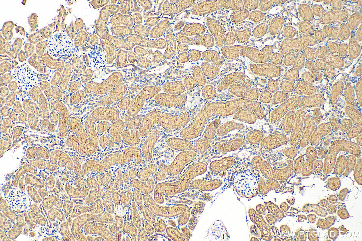 Immunohistochemistry (IHC) staining of rat kidney tissue using EPHX2 Polyclonal antibody (10833-1-AP)