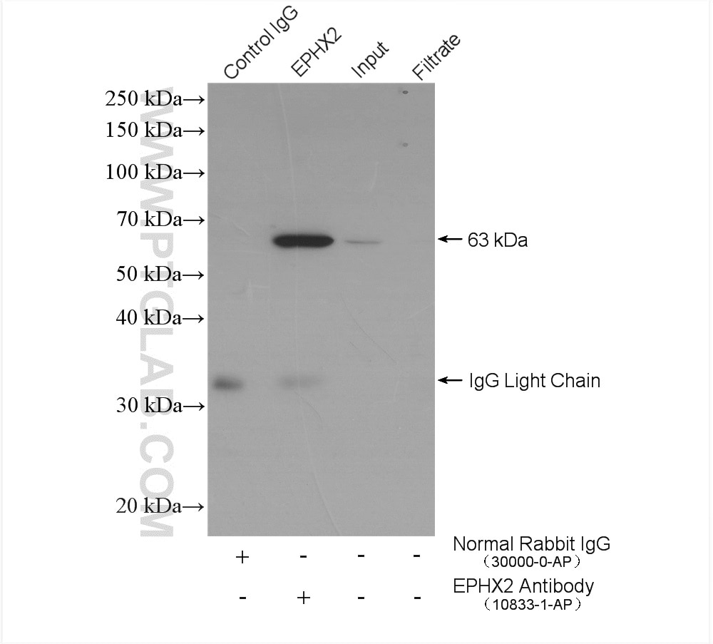 Immunoprecipitation (IP) experiment of mouse large intestine tissue using EPHX2 Polyclonal antibody (10833-1-AP)