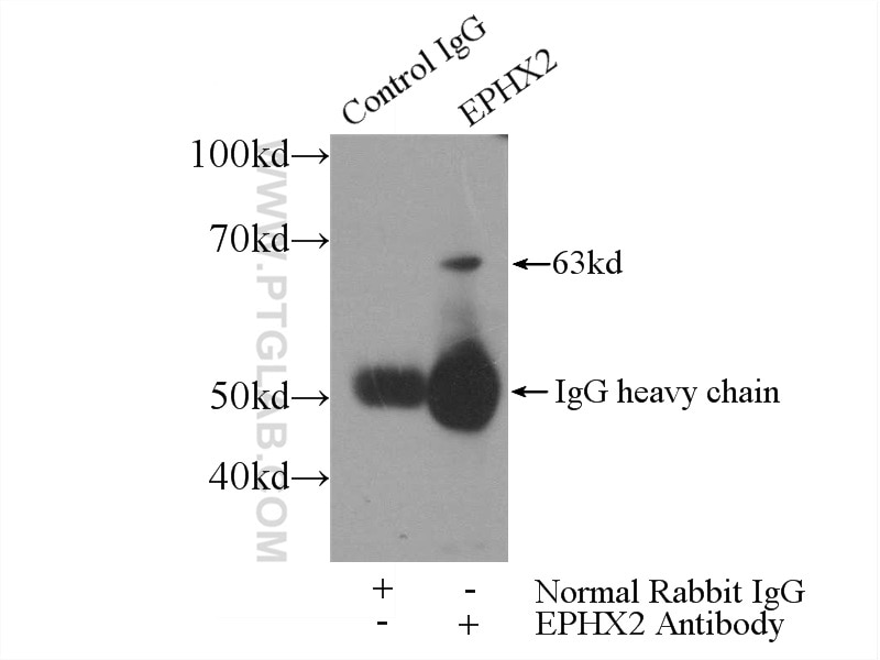 Immunoprecipitation (IP) experiment of HEK-293 cells using EPHX2 Polyclonal antibody (10833-1-AP)