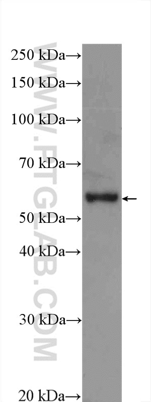 Western Blot (WB) analysis of HEK-293T cells using EPHX2 Polyclonal antibody (10833-1-AP)