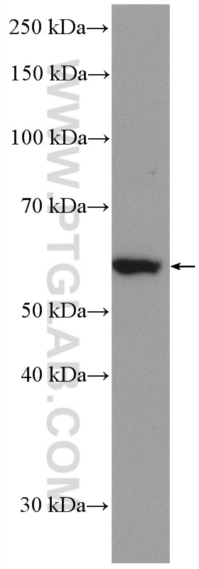 Western Blot (WB) analysis of HEK-293 cells using EPHX2 Polyclonal antibody (10833-1-AP)