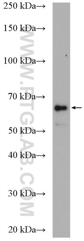 Western Blot (WB) analysis of mouse colon tissue using EPHX2 Polyclonal antibody (10833-1-AP)