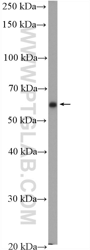 Western Blot (WB) analysis of rat cerebellum tissue using EPHX2 Polyclonal antibody (10833-1-AP)