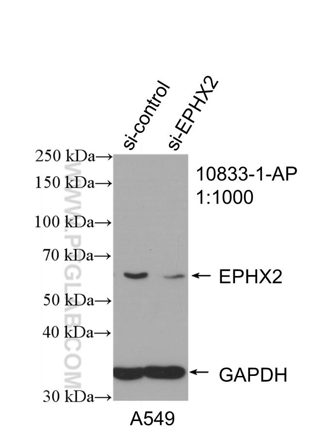 Western Blot (WB) analysis of A549 cells using EPHX2 Polyclonal antibody (10833-1-AP)