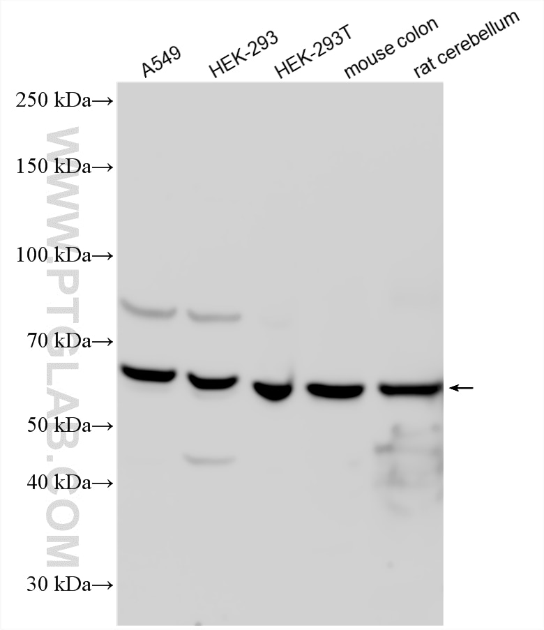 WB analysis using 10833-1-AP Western Blot (WB) analysis of various lysates using EPHX2 Polyclonal antibody (10833-1-AP)