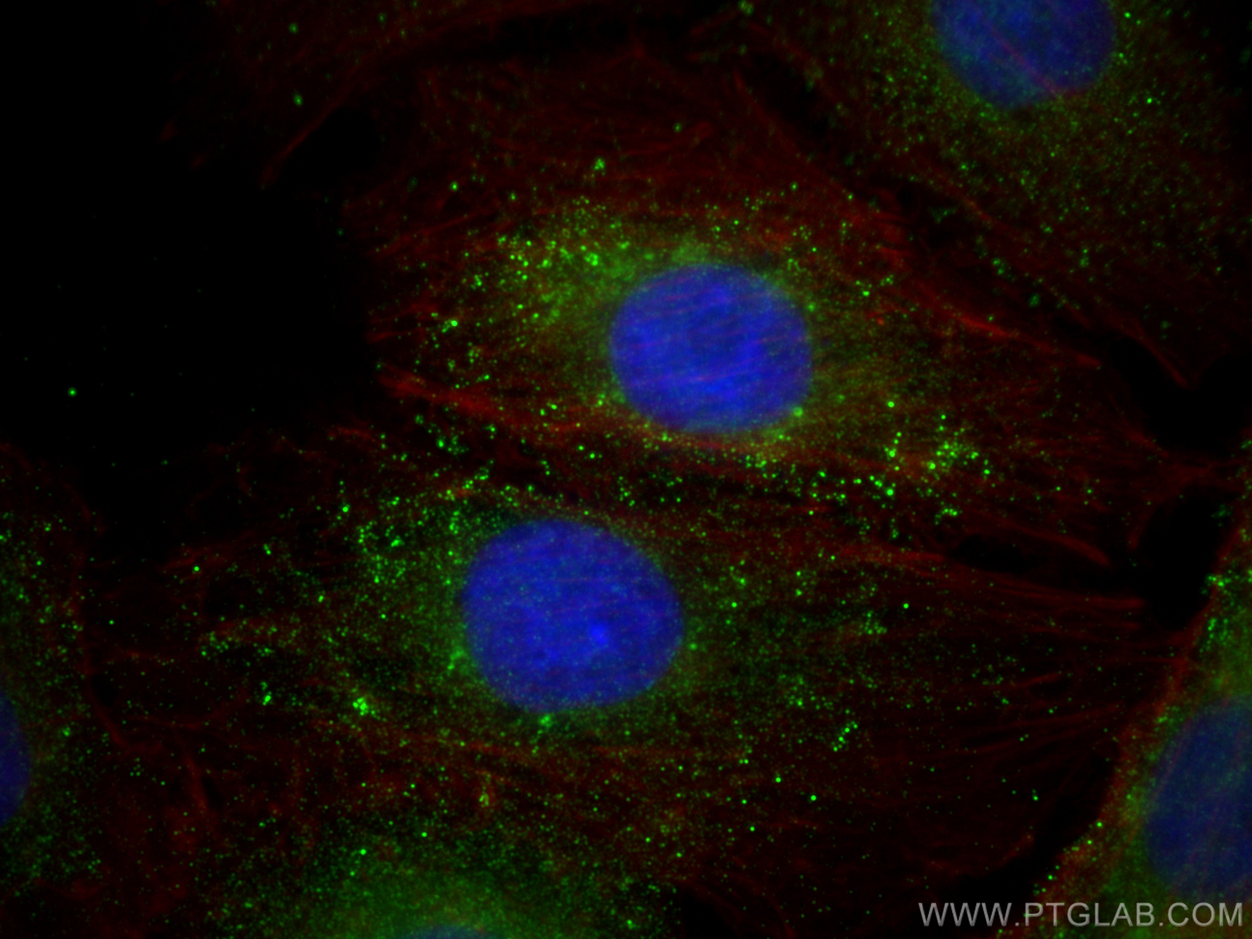 Immunofluorescence (IF) / fluorescent staining of A549 cells using EPHX2 Monoclonal antibody (67322-1-Ig)