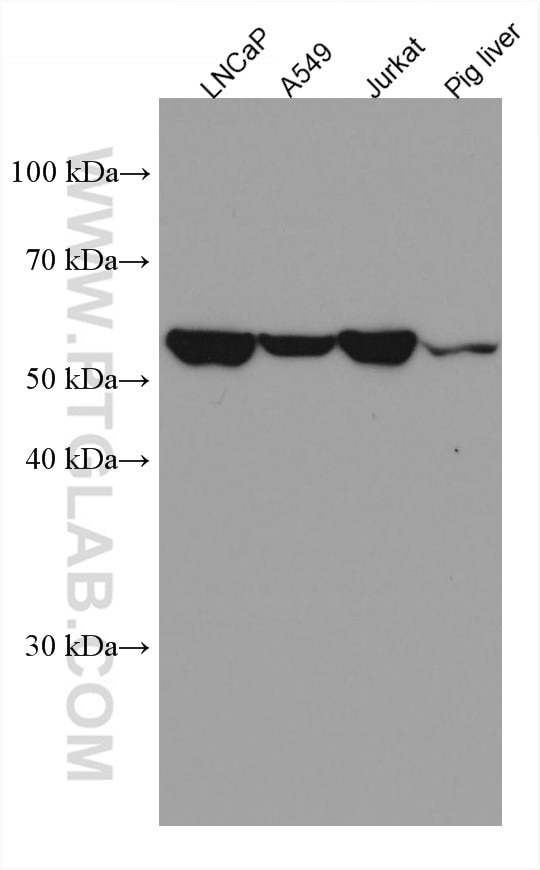 Western Blot (WB) analysis of various lysates using EPHX2 Monoclonal antibody (67322-1-Ig)