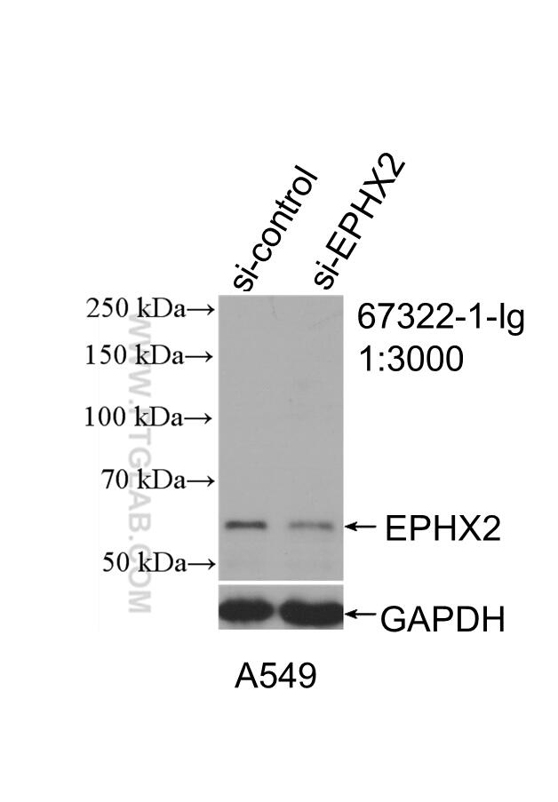 Western Blot (WB) analysis of A549 cells using EPHX2 Monoclonal antibody (67322-1-Ig)