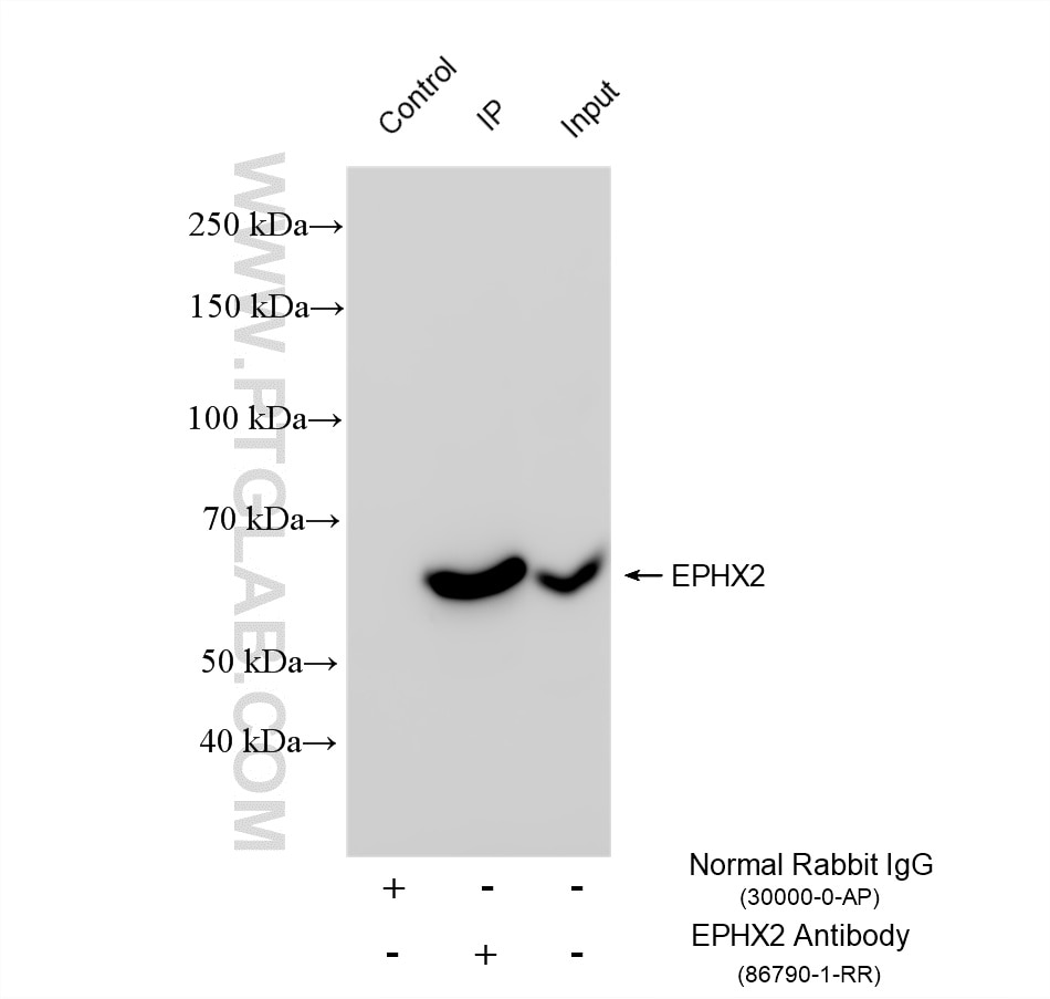 Immunoprecipitation (IP) experiment of mouse colon tissue using EPHX2 Recombinant monoclonal antibody (86790-1-RR)