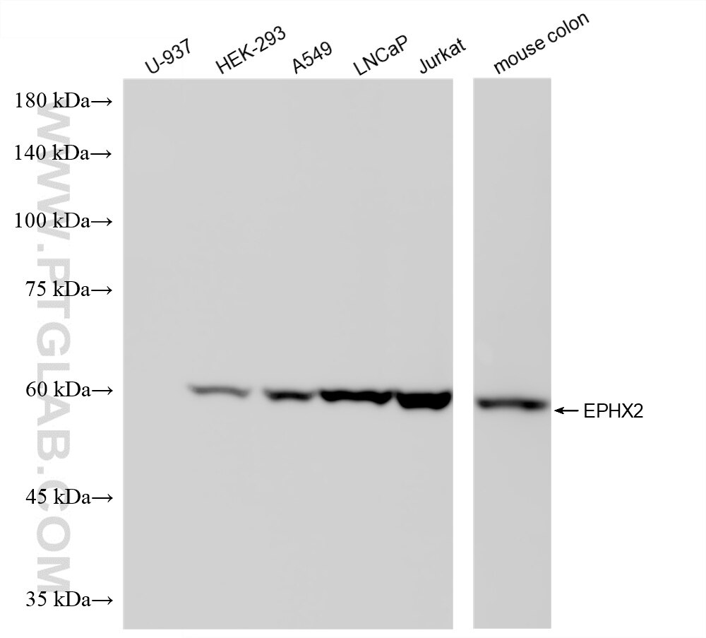 Western Blot (WB) analysis of various lysates using EPHX2 Recombinant monoclonal antibody (86790-1-RR)