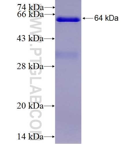 EPHX2 fusion protein Ag1283 SDS-PAGE