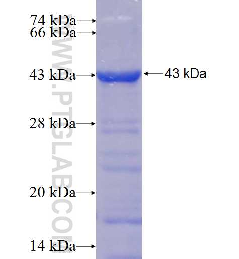 EPHX2 fusion protein Ag4870 SDS-PAGE
