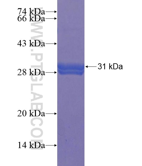 EPHX3 fusion protein Ag22277 SDS-PAGE