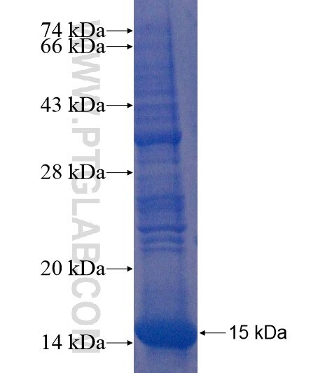 EPHX4 fusion protein Ag22238 SDS-PAGE