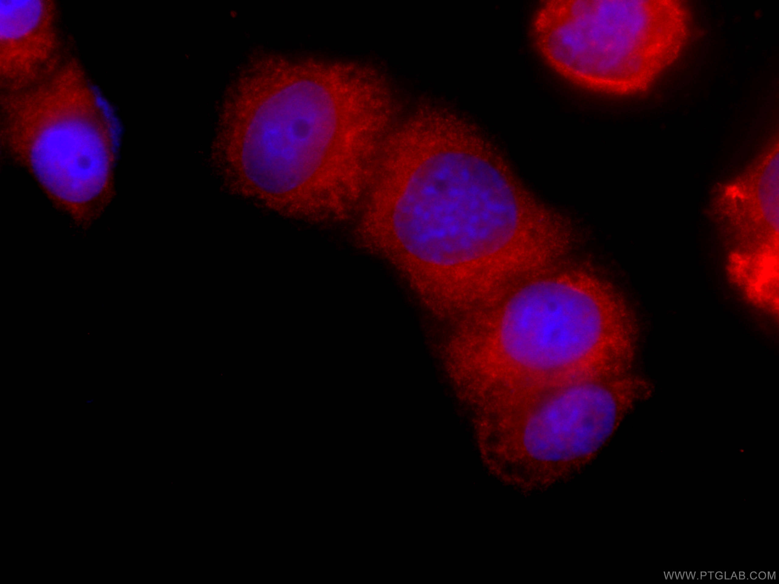 Immunofluorescence (IF) / fluorescent staining of HeLa cells using CoraLite®594-conjugated EPLIN Monoclonal antibody (CL594-66071)