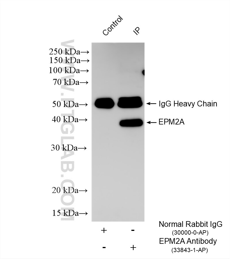 IP experiment of mouse skeletal muscle using 33843-1-AP (same clone as 33843-1-PBS) Immunoprecipitation (IP) experiment of mouse skeletal muscle tissue using EPM2A/Laforin Polyclonal antibody (33843-1-AP)