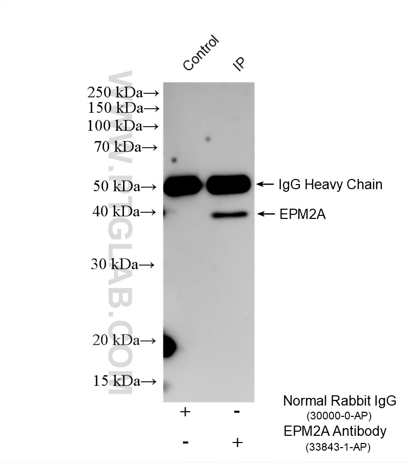 IP experiment of HL-60 using 33843-1-AP (same clone as 33843-1-PBS) Immunoprecipitation (IP) experiment of HL-60 cells using EPM2A/Laforin Polyclonal antibody (33843-1-AP)