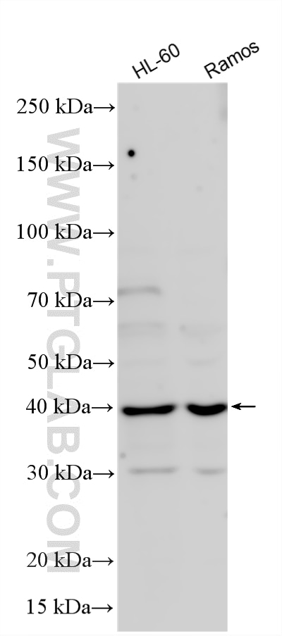 WB analysis using 33843-1-AP (same clone as 33843-1-PBS) Western Blot (WB) analysis of various lysates using EPM2A/Laforin Polyclonal antibody (33843-1-AP)