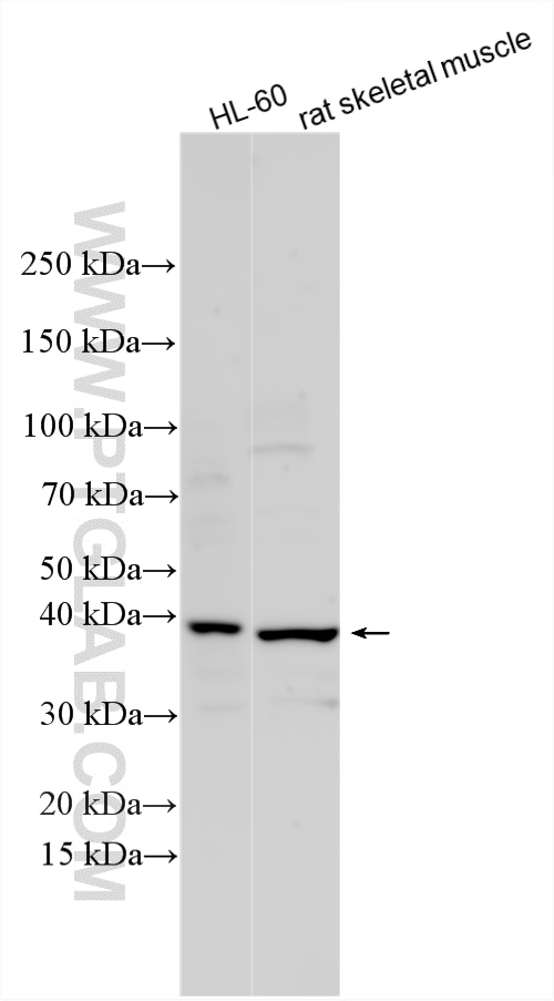 WB analysis using 33843-1-AP (same clone as 33843-1-PBS) Western Blot (WB) analysis of various lysates using EPM2A/Laforin Polyclonal antibody (33843-1-AP)