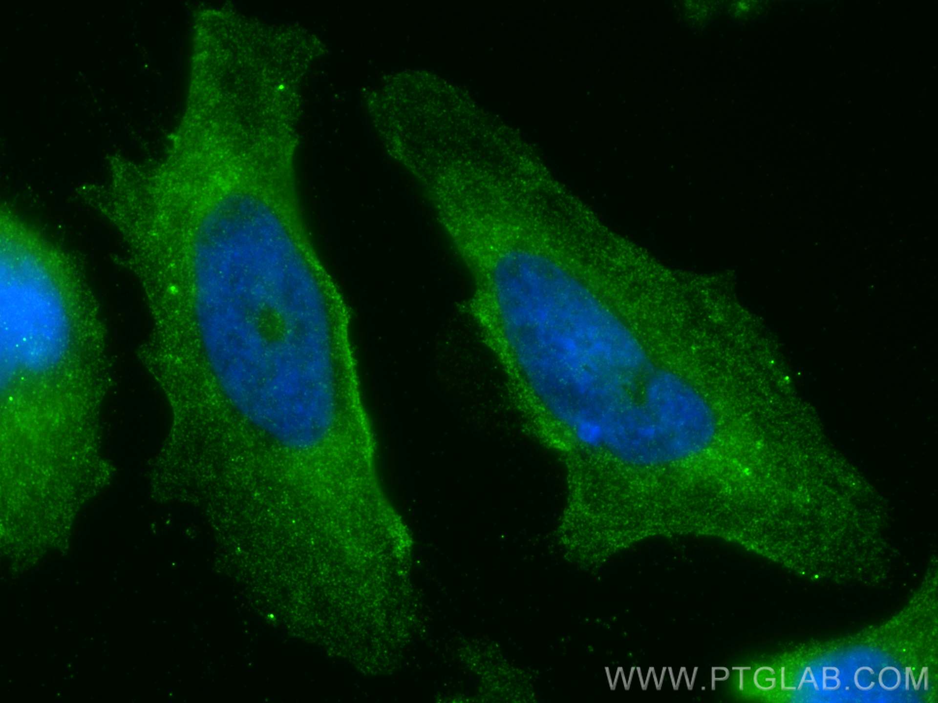 Immunofluorescence (IF) / fluorescent staining of HeLa cells using EPN1 Polyclonal antibody (14469-1-AP)