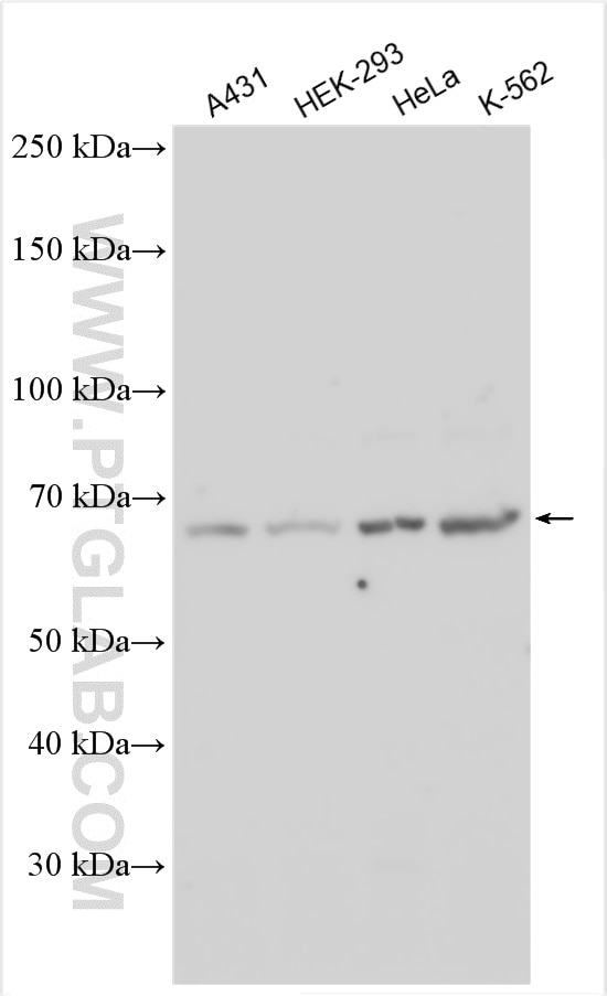 Western Blot (WB) analysis of various lysates using EPN1 Polyclonal antibody (14469-1-AP)