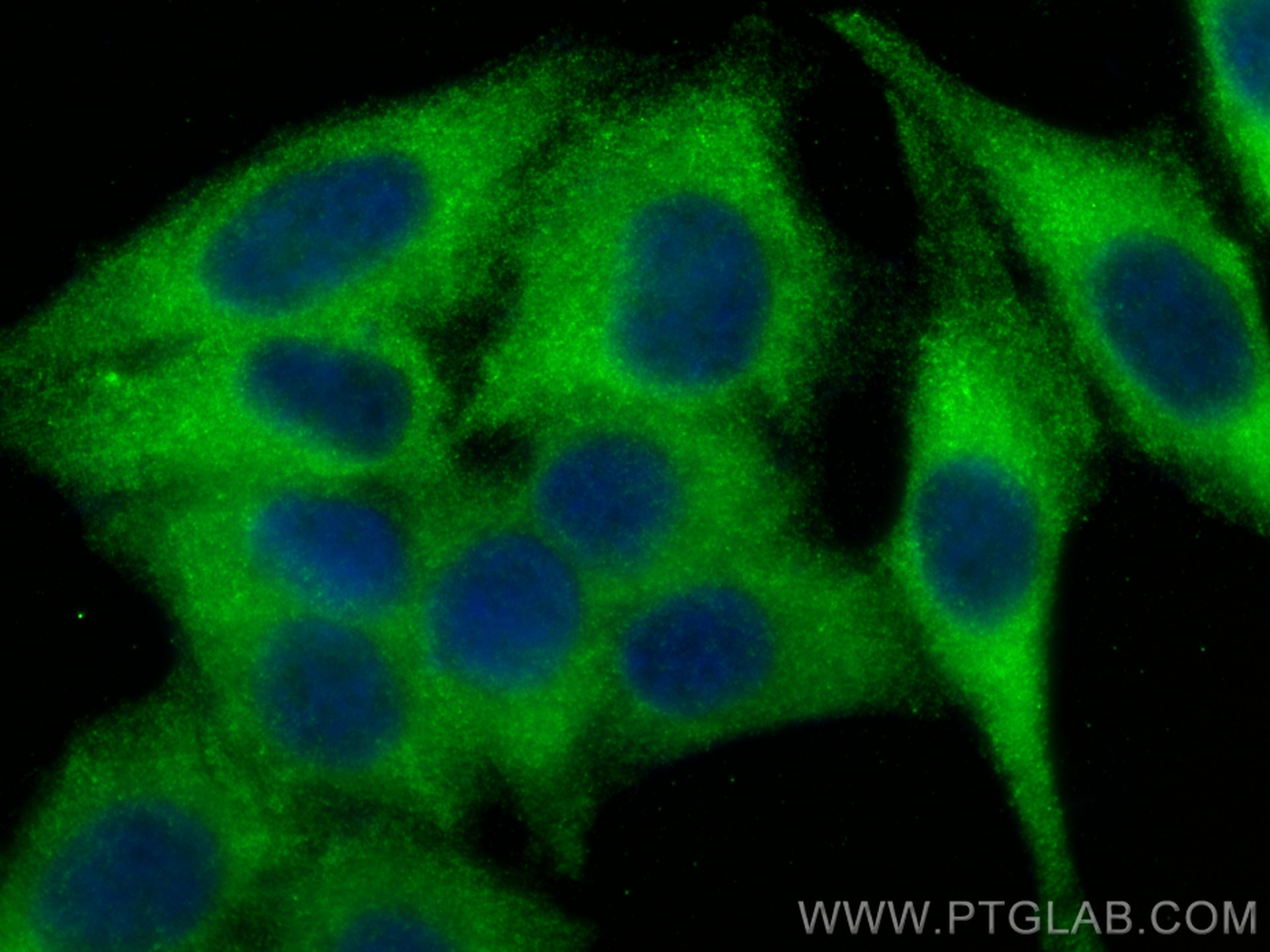 Immunofluorescence (IF) / fluorescent staining of HepG2 cells using EPN2 Polyclonal antibody (31334-1-AP)