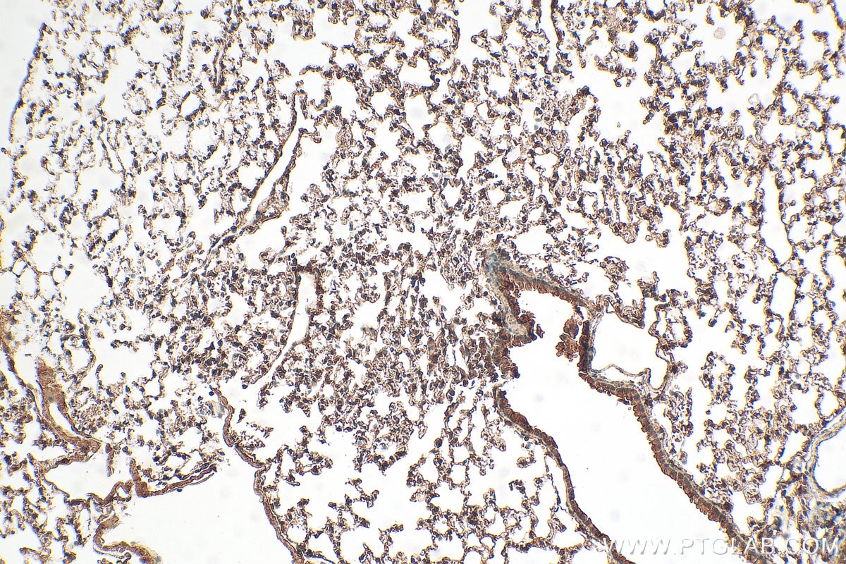 Immunohistochemistry (IHC) staining of mouse lung tissue using EPN2 Polyclonal antibody (31334-1-AP)