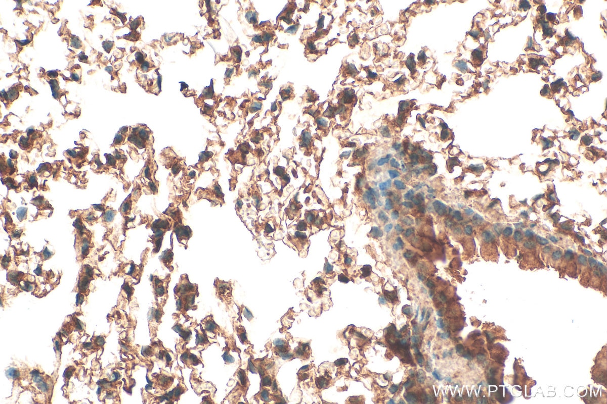 Immunohistochemistry (IHC) staining of mouse lung tissue using EPN2 Polyclonal antibody (31334-1-AP)
