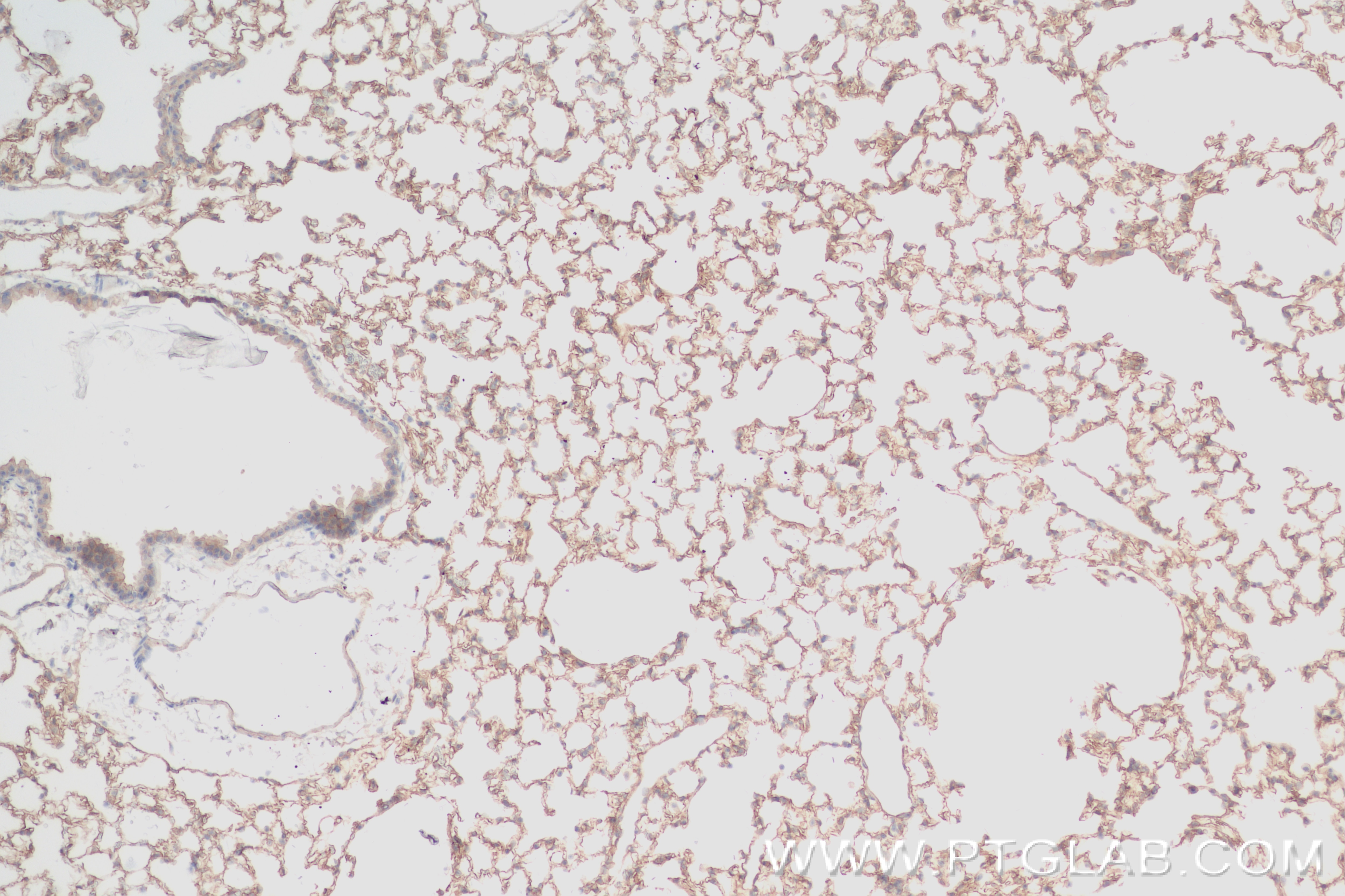 Immunohistochemistry (IHC) staining of mouse lung tissue using EPN2 Recombinant antibody (84366-5-RR)