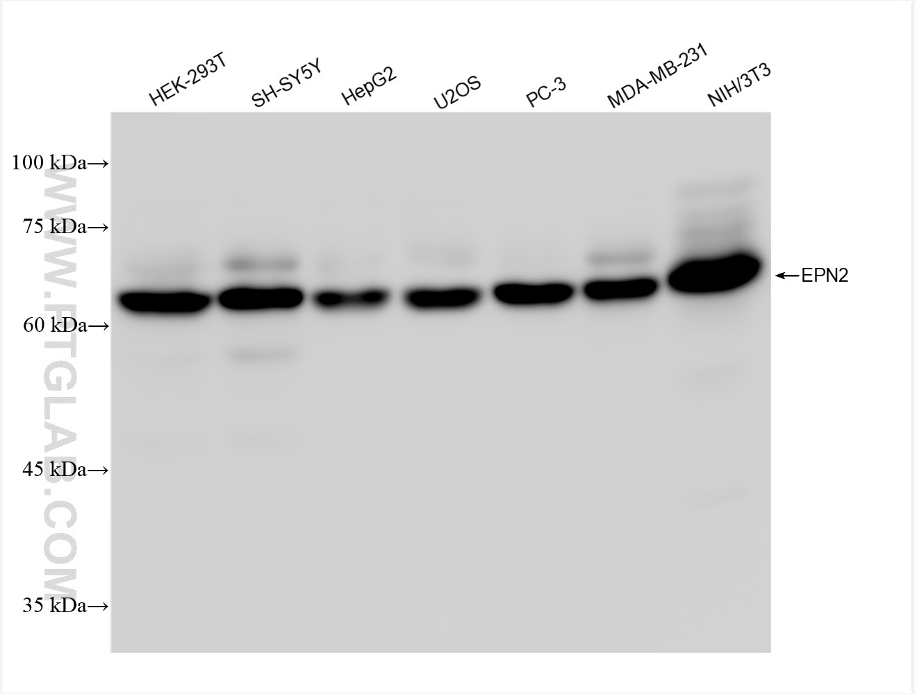 Western Blot (WB) analysis of various lysates using EPN2 Recombinant antibody (84366-5-RR)