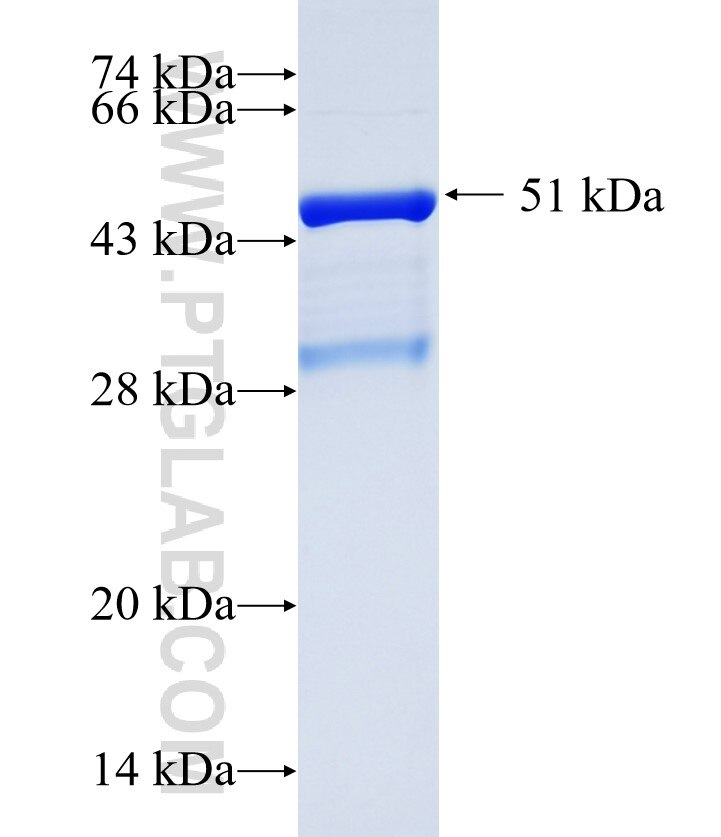 EPN2 fusion protein Ag35194 SDS-PAGE