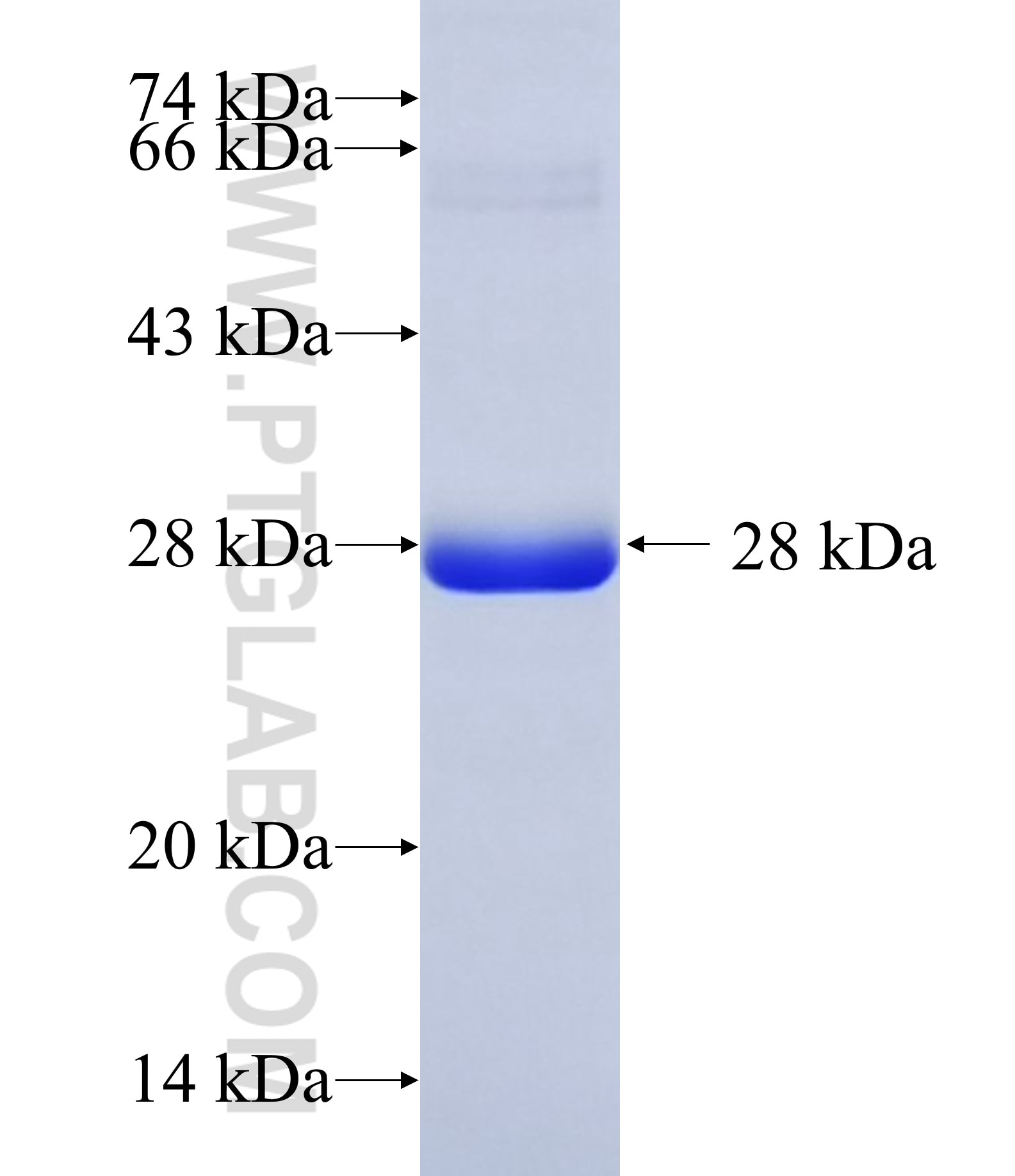 EPN2 fusion protein Ag35241 SDS-PAGE EPN2 fusion protein Ag35241 SDS-PAGE