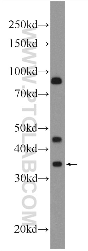 EPO Polyclonal antibody