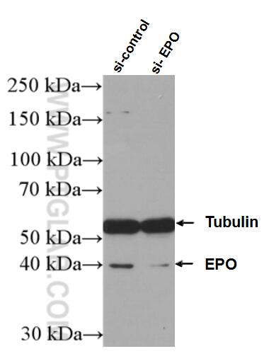 Western Blot (WB) analysis of HEK-293 cells using EPO Polyclonal antibody (17908-1-AP)