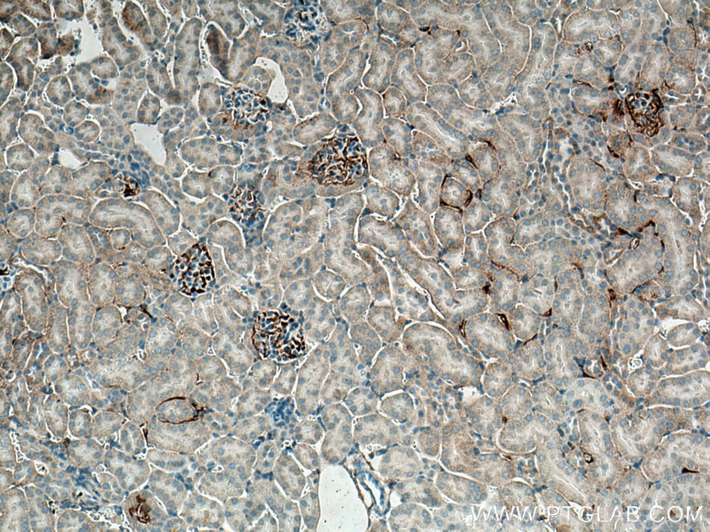 Immunohistochemistry (IHC) staining of mouse kidney tissue using EPO Monoclonal antibody (66975-1-Ig)