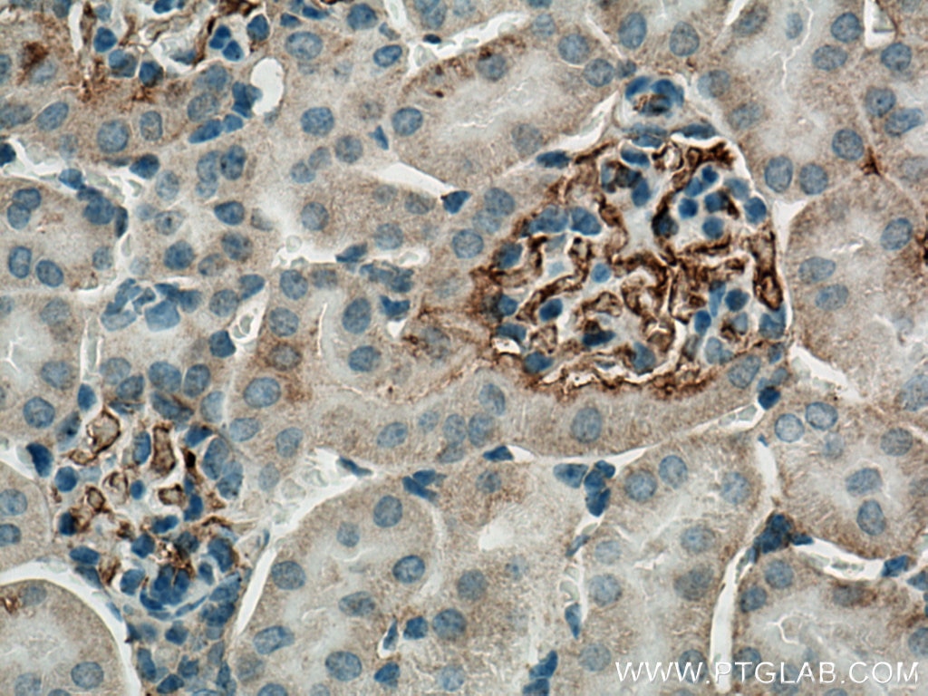 Immunohistochemistry (IHC) staining of mouse kidney tissue using EPO Monoclonal antibody (66975-1-Ig)